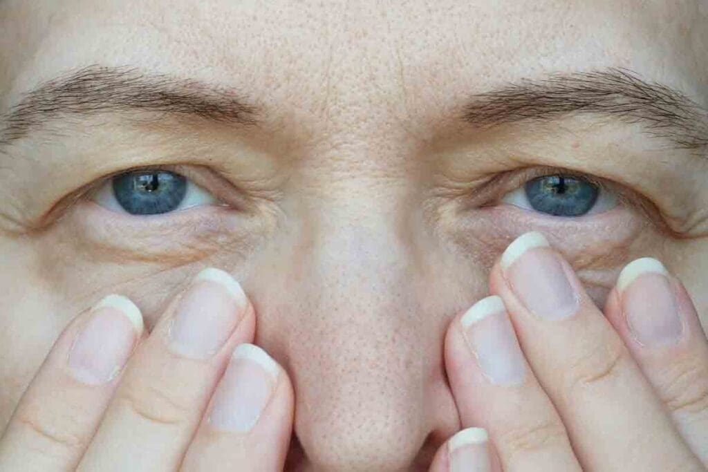 7 Ways to Check Anemia Eyelids and How Low Iron Causes Heart Palpitations