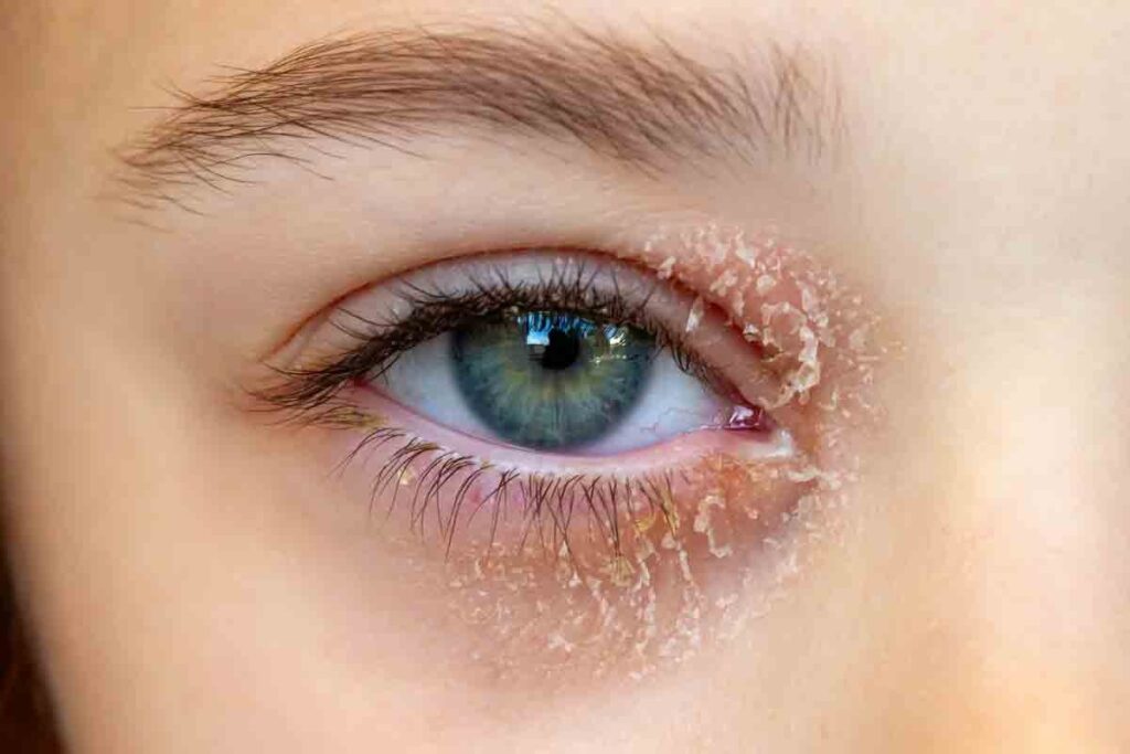 Eyelid Pale or Yellow? What the Inside of Your Eyelids Should Look Like, Anemia Signs, and Normal Color