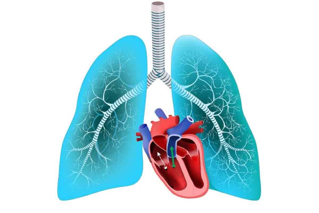Pulmonary Embolism Recovery Time: 7 Key Steps for a Safe Return to Health