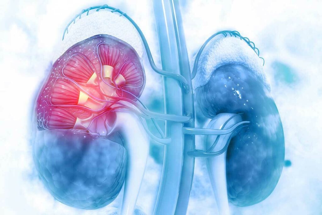 Renal Scan Results Interpretation: 7 Key Steps