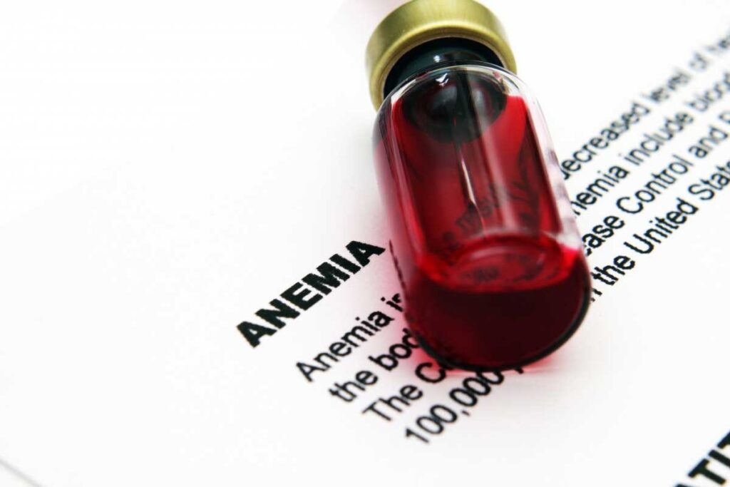 Iron Dose for Anemia in Adults: 7 Essential Guidelines and Treatment Facts