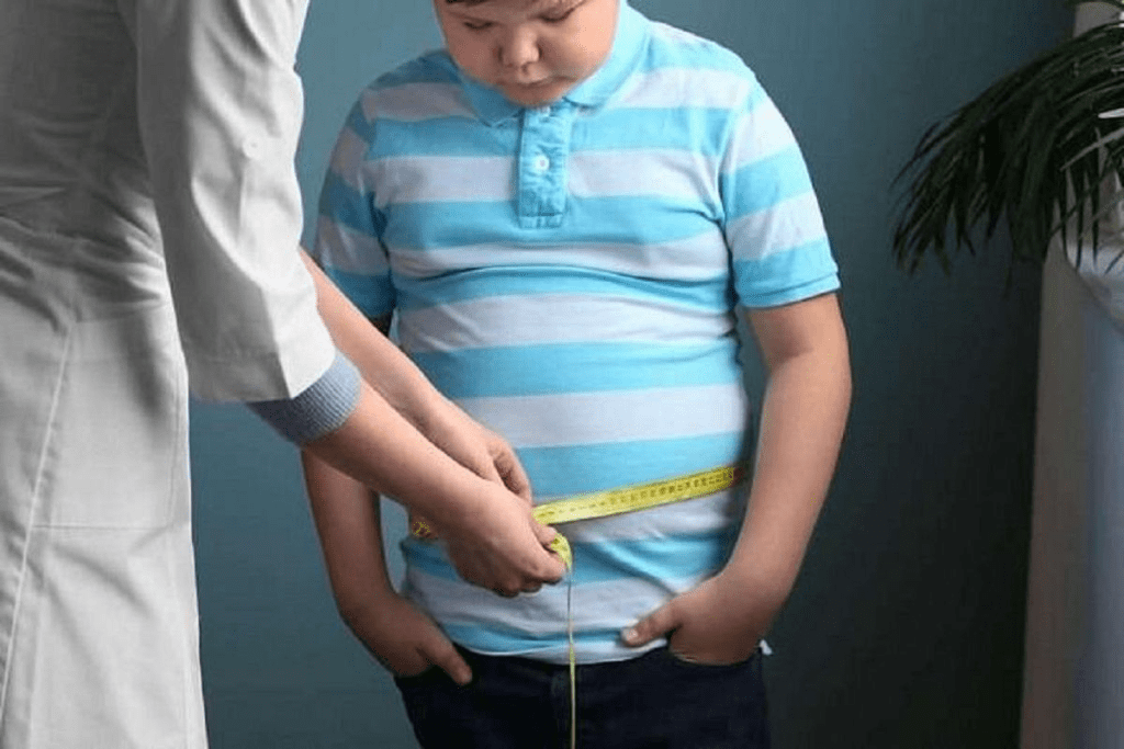 Child Obesity Point: When a Kid Is Considered Obese