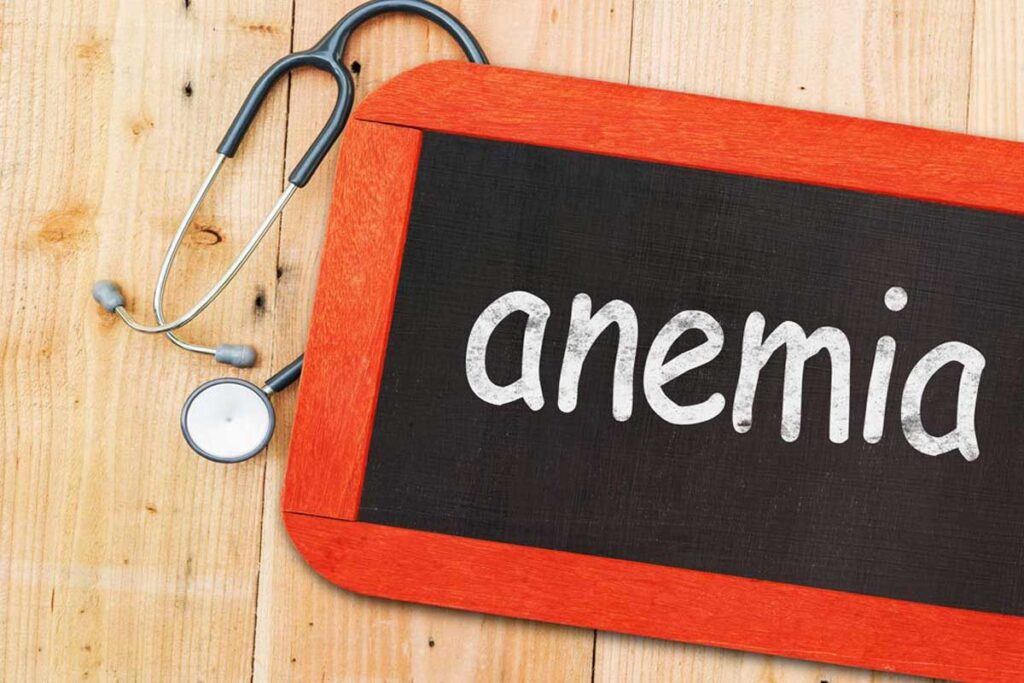 How to Manage Anemia: What to Take for Anemiaand When Transfusions are Needed
