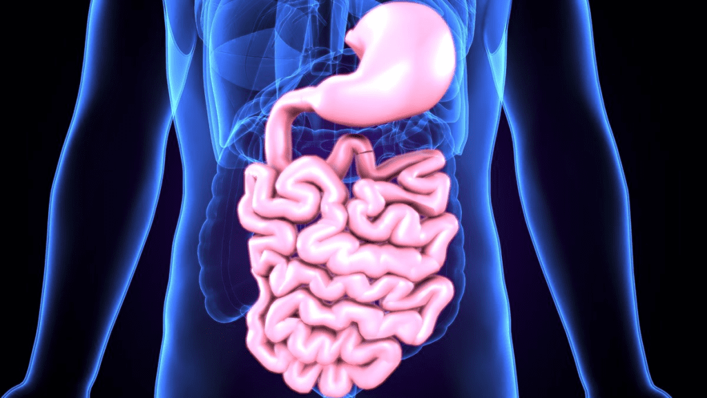 Common GI Malformation: Most Frequent Types