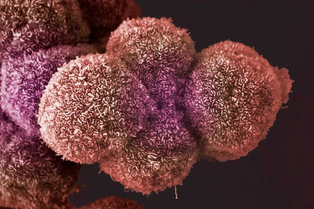 Top 40 Kinds of Cancer: A Complete List of Cancer Types & Tumors