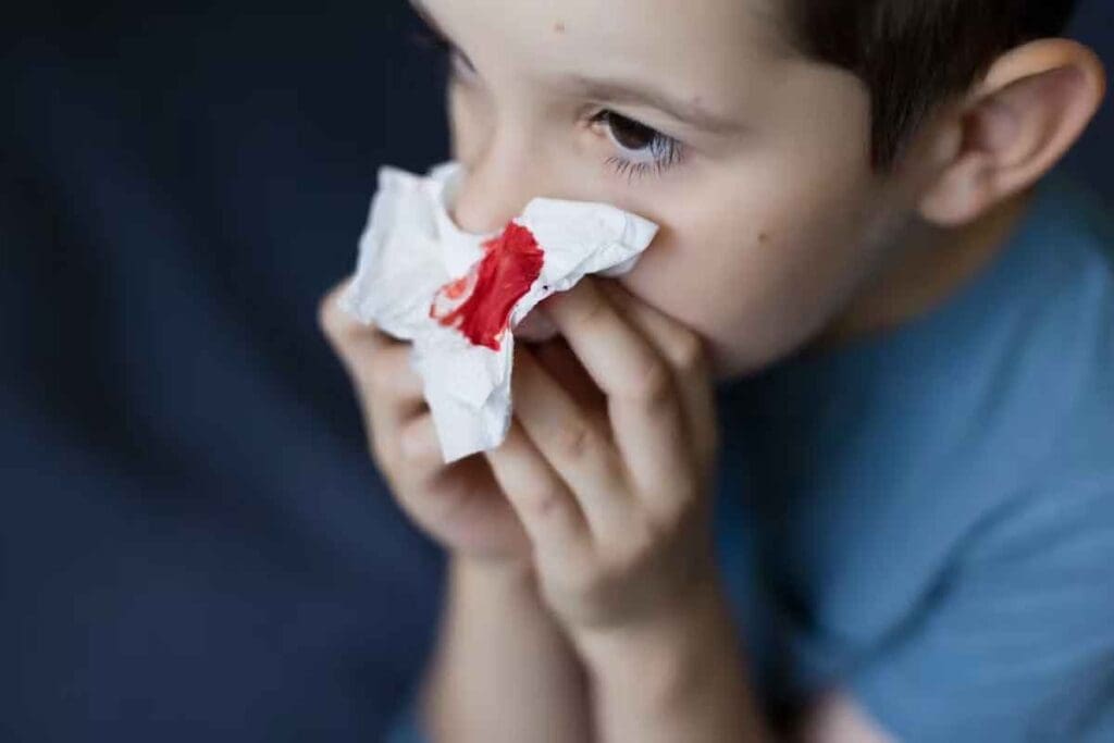 Leukemia Nosebleed: 7 Critical Symptoms to Know