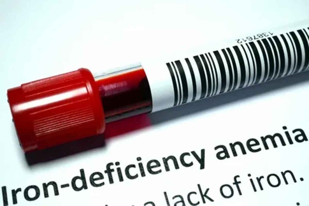 How To Know If You Have Anemia: Key Signs & Diagnosis