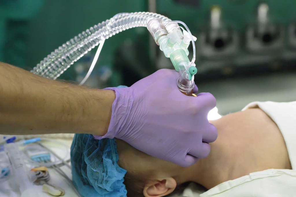 General Anesthesia: The Ultimate Risk Explained