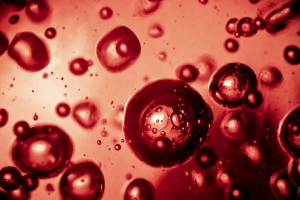 Can Low Hemoglobin Cause Fever: Crucial Facts Explained