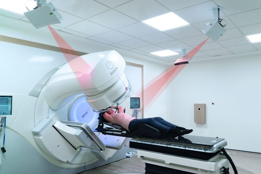 After Effects of Radiotherapy: Know the Risks
