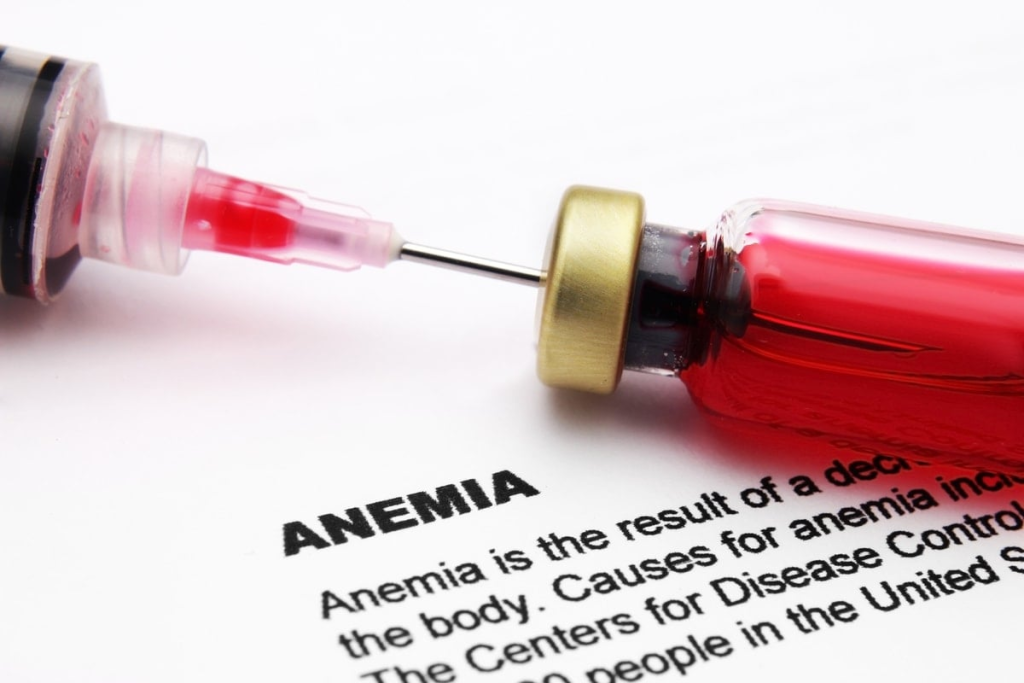 Signs for Anemia: Red Flags to Watch