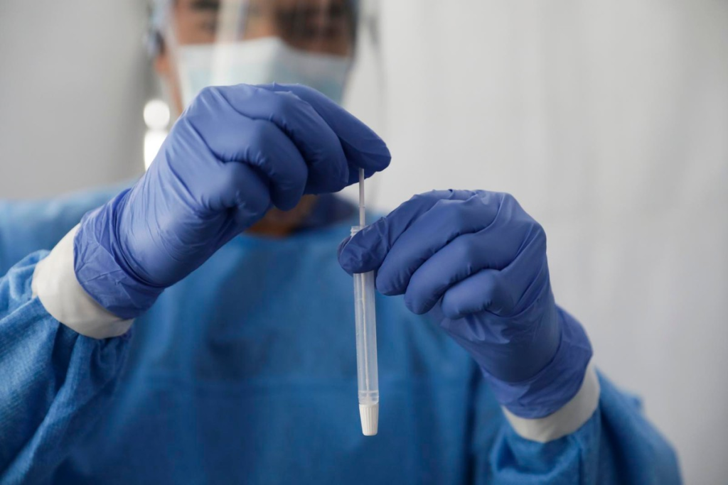 Test for Lupus: CBC and Auto Diff with Reflex