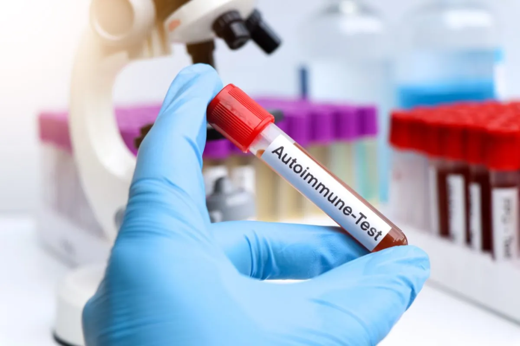 Rheumatology for Autoimmune Disorders