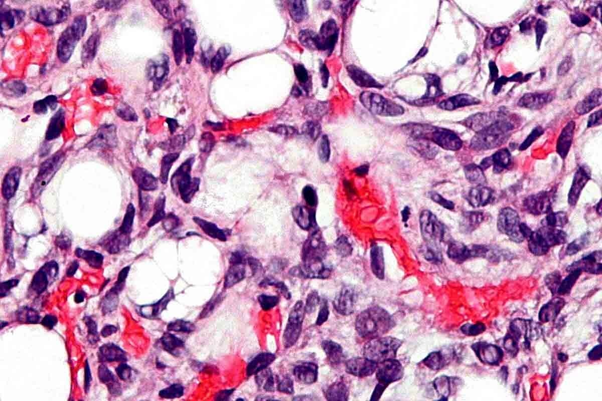 image 6271 LIV Hospital