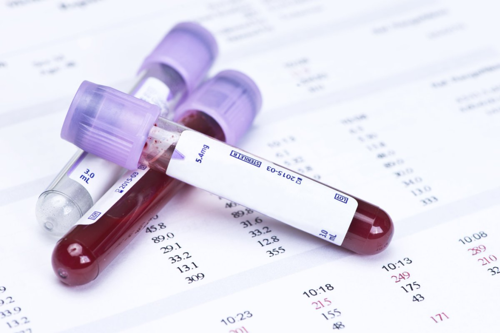 Natural Blood Thinners: An Amazing, Powerful List