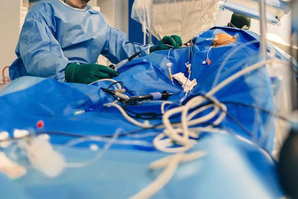 Is Catheter Ablation Safe? Key Facts & Risks