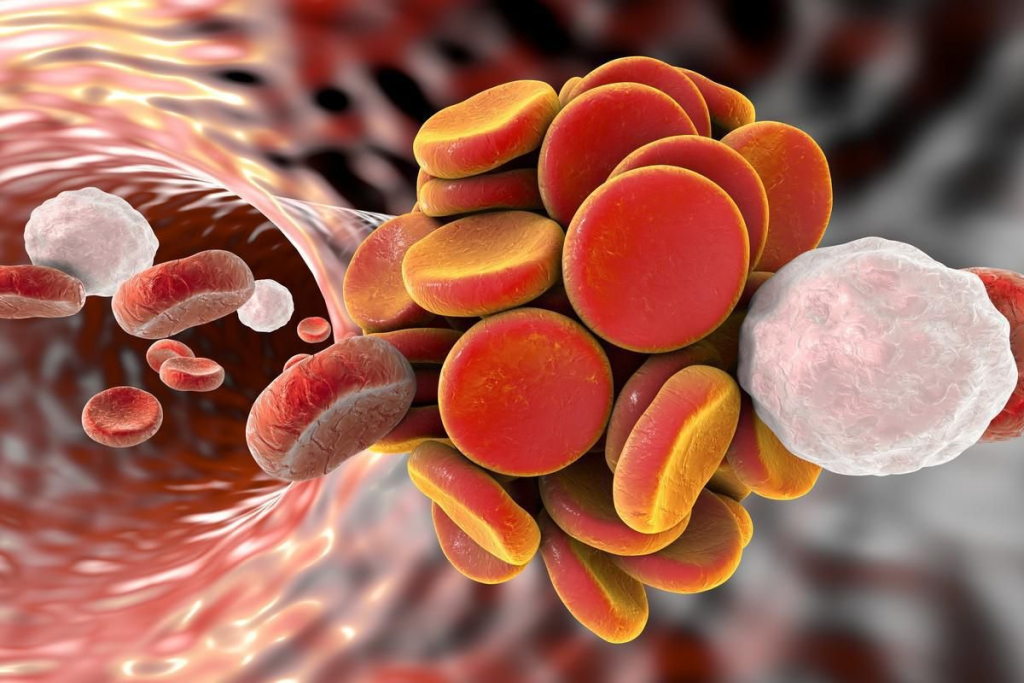 Canker Sore: The Ultimate, Fast Relief Guide