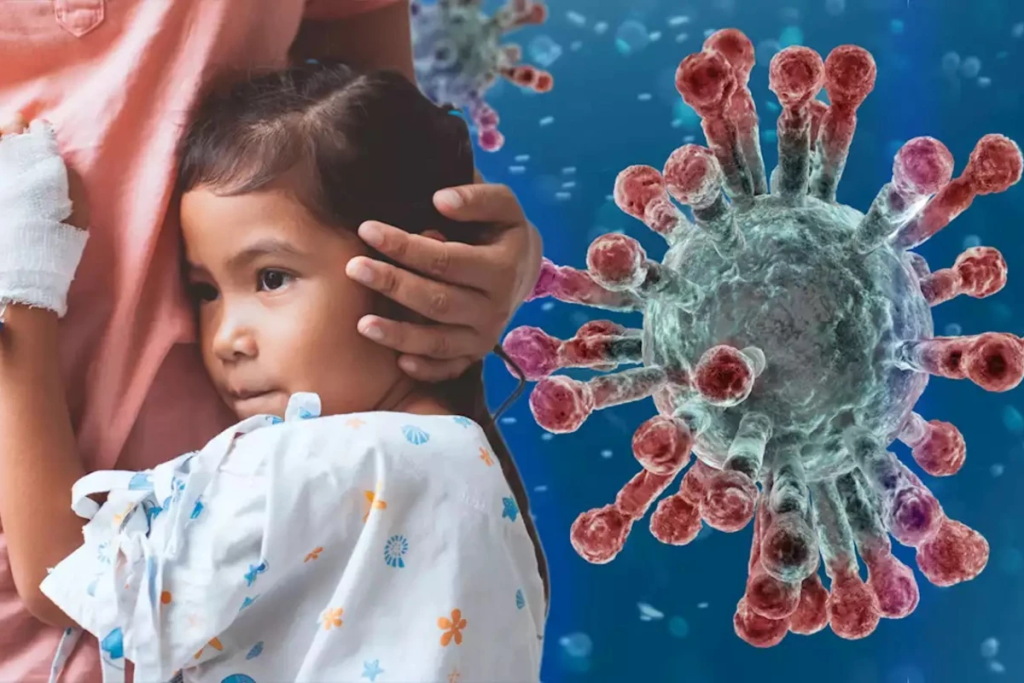 Common Cause Thrombocytopenia Children: Crucial Info