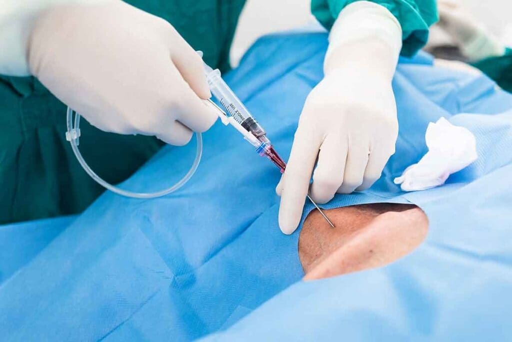 How Safe Is Cardiac Ablation? Learn the Facts