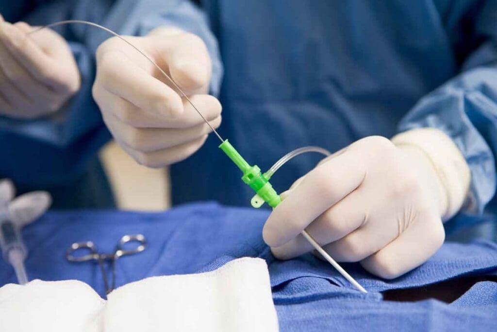 Angio Interventional: Key Facts You Should Know