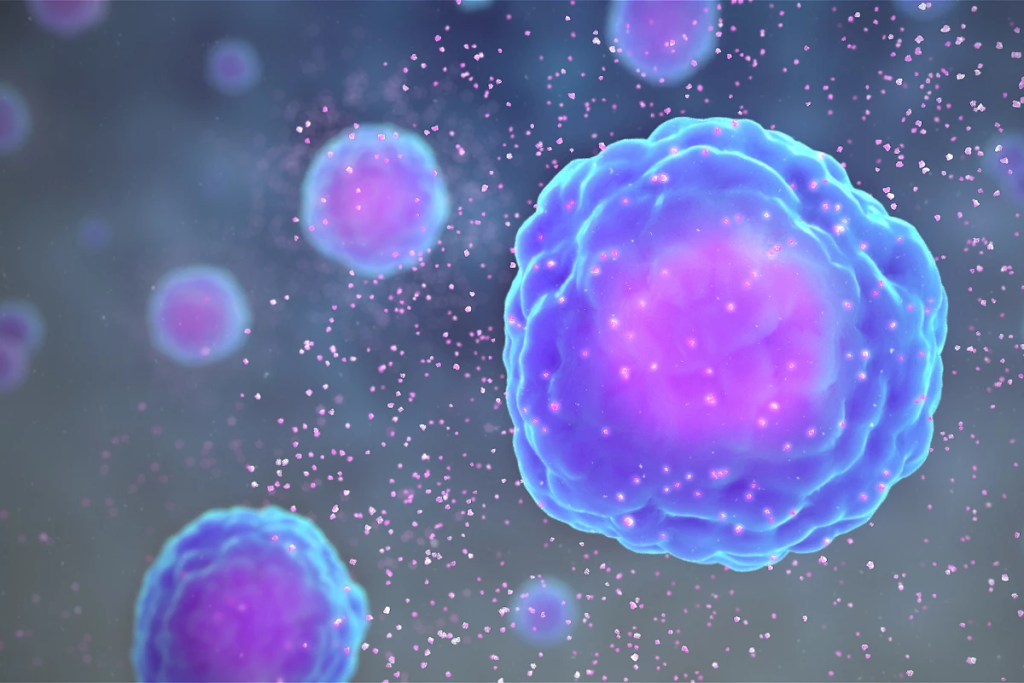 Miller Fisher Syndrome: Expert Rare Condition