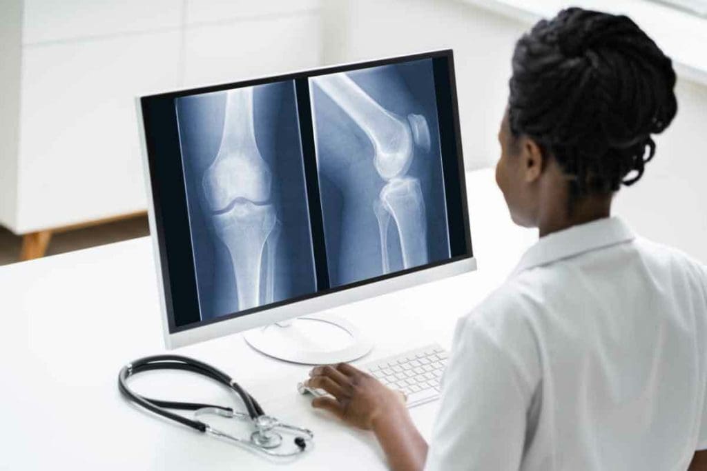 Bone Scan Versus CT Scan: Key Differences