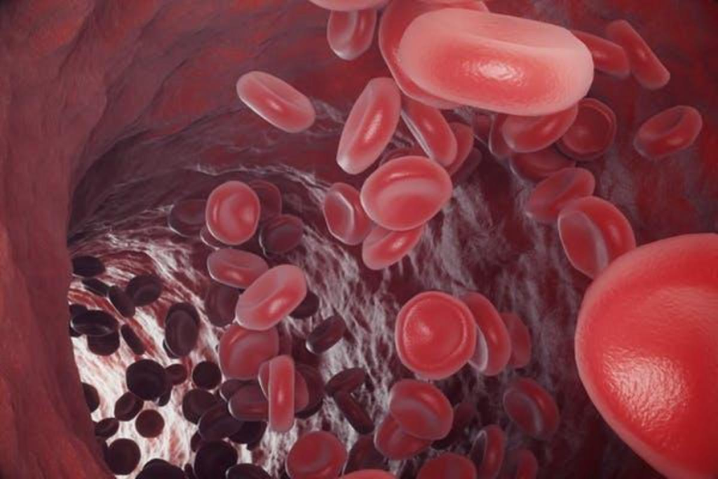 Iron Deficiency: Crucial Guide to Serious Signs