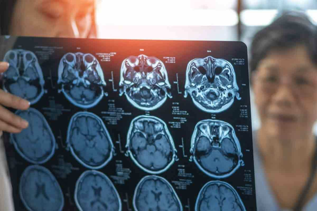 Cat CT: 7 Key Facts About CT Scans