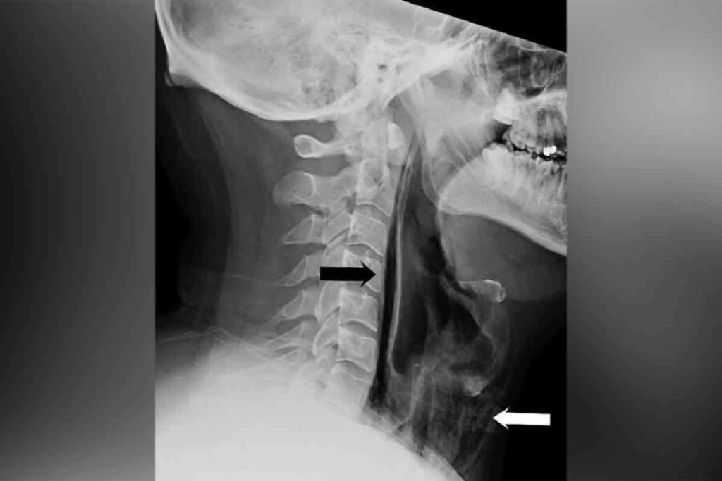 Throat Scan: 7 Essential Methods to Detect Cancer Quickly
