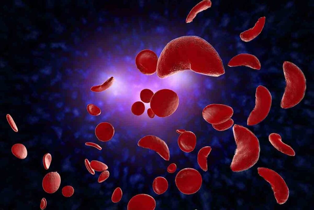 How Do You Know If You Have Sickle Cell Trait?