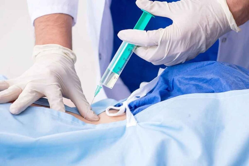 Transforaminal Epidural Steroid Injection Recovery Time