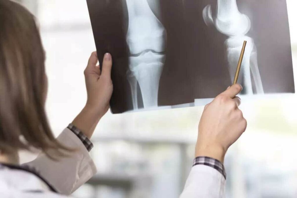 X Ray vs CT vs MRI: 7 Essential Differences & Uses Explained