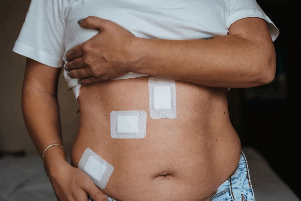 Pediatric Hernia Surgery: recovery from inguinal hernia surgery