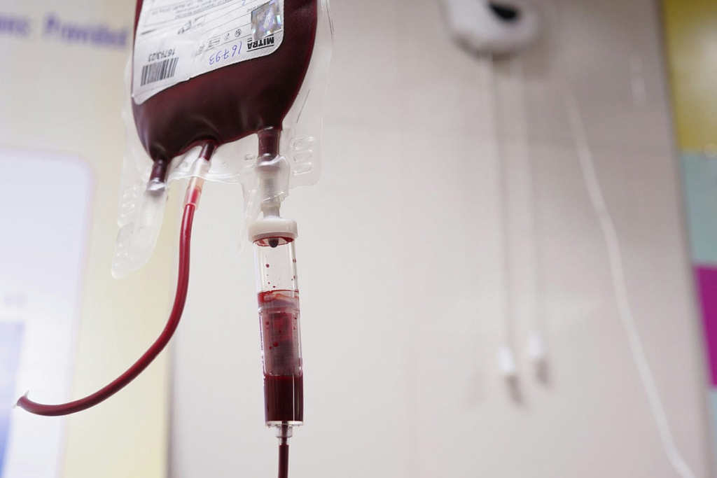 Alternatives to Blood Transfusion: Options