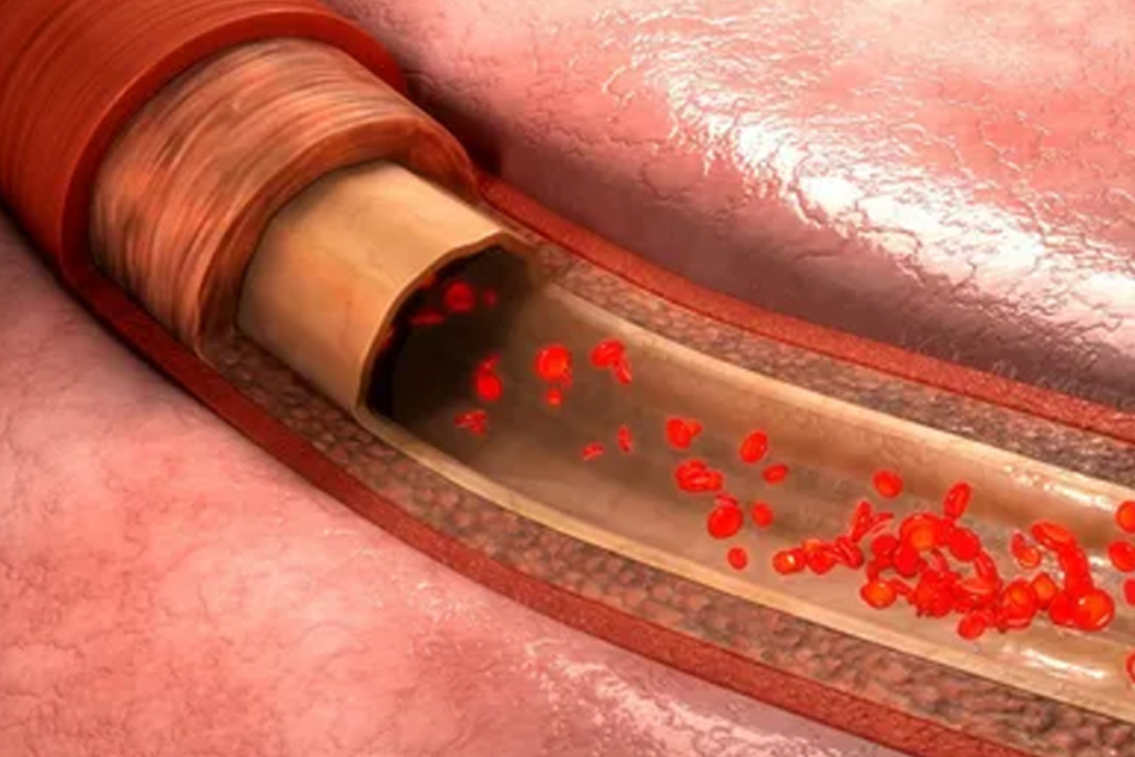 Alternatives to Blood Transfusion: Options