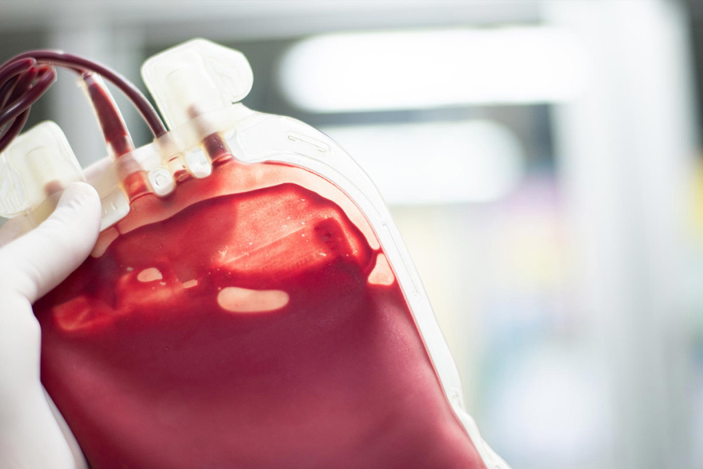 Blood Transfusion Risks and Complications
