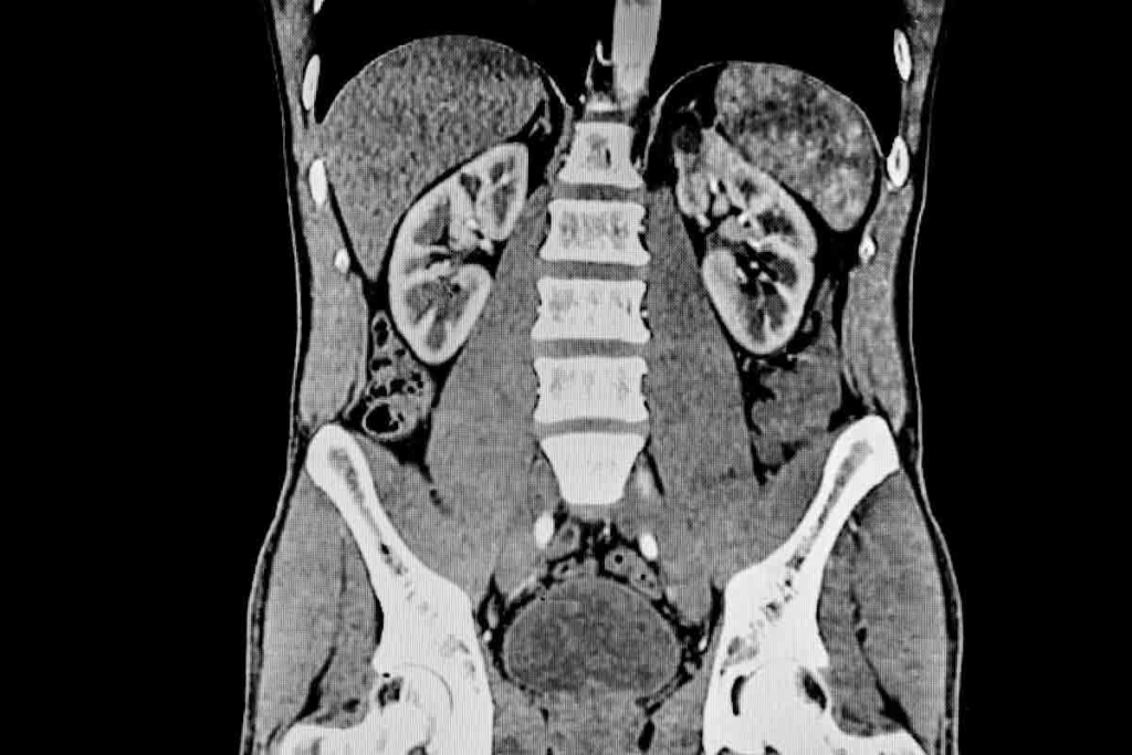 Renal CT Scan: Step-by-Step Prep Guide