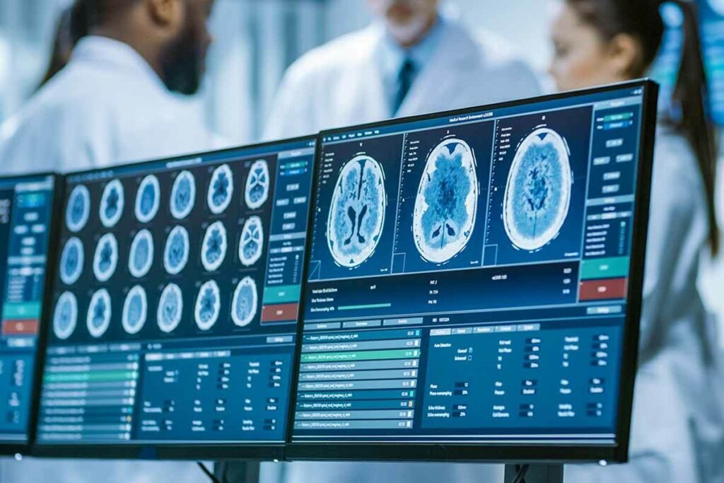 Nuclear Medicine Camera: The Ultimate Powerful Guide