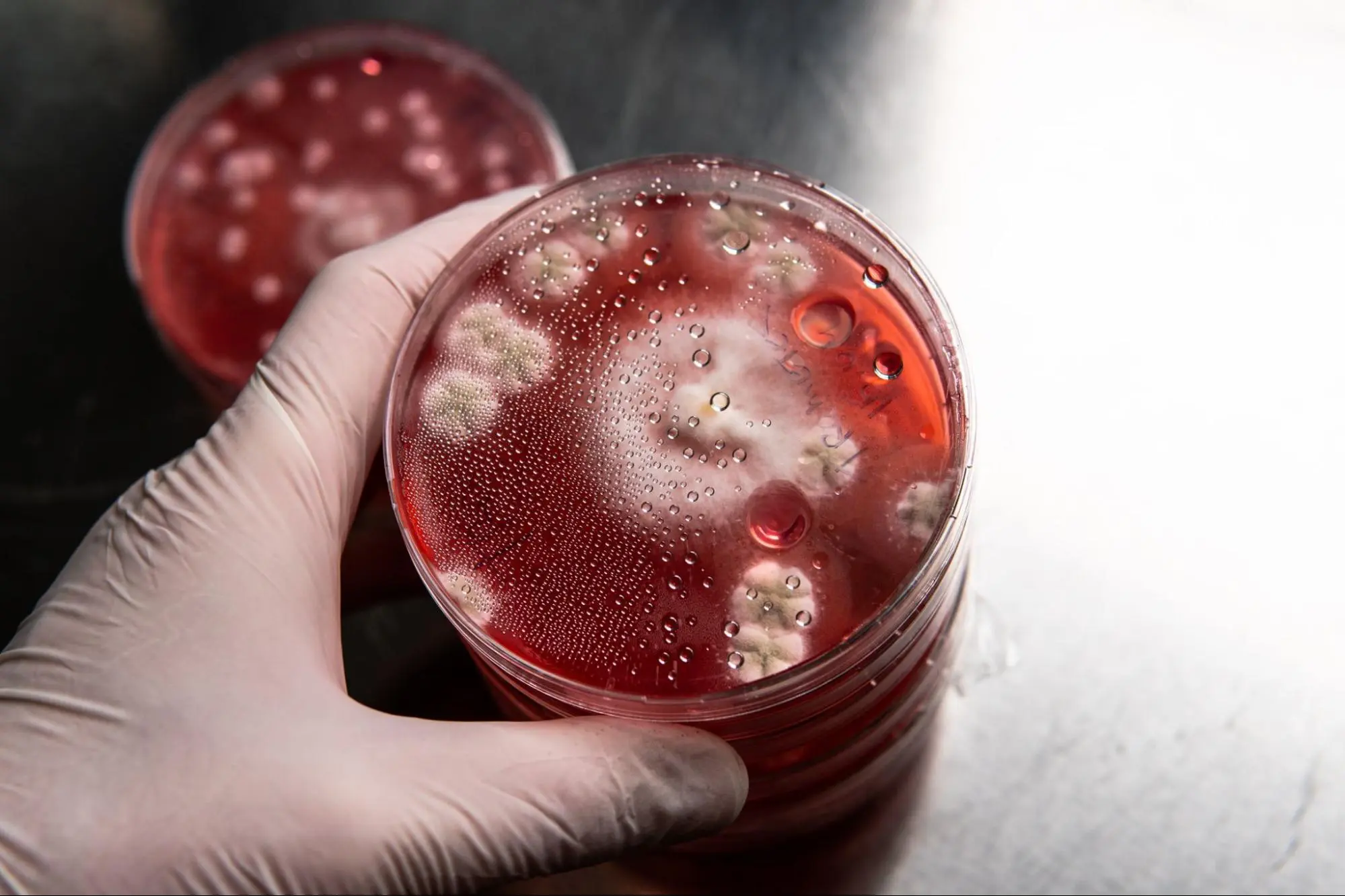 Understanding Hematopoietic Stem Cell Transplantation (HSCT): A Life-Saving Procedure