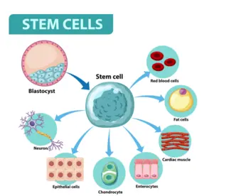 allogeneic hematopoietic stem cell transplantation process