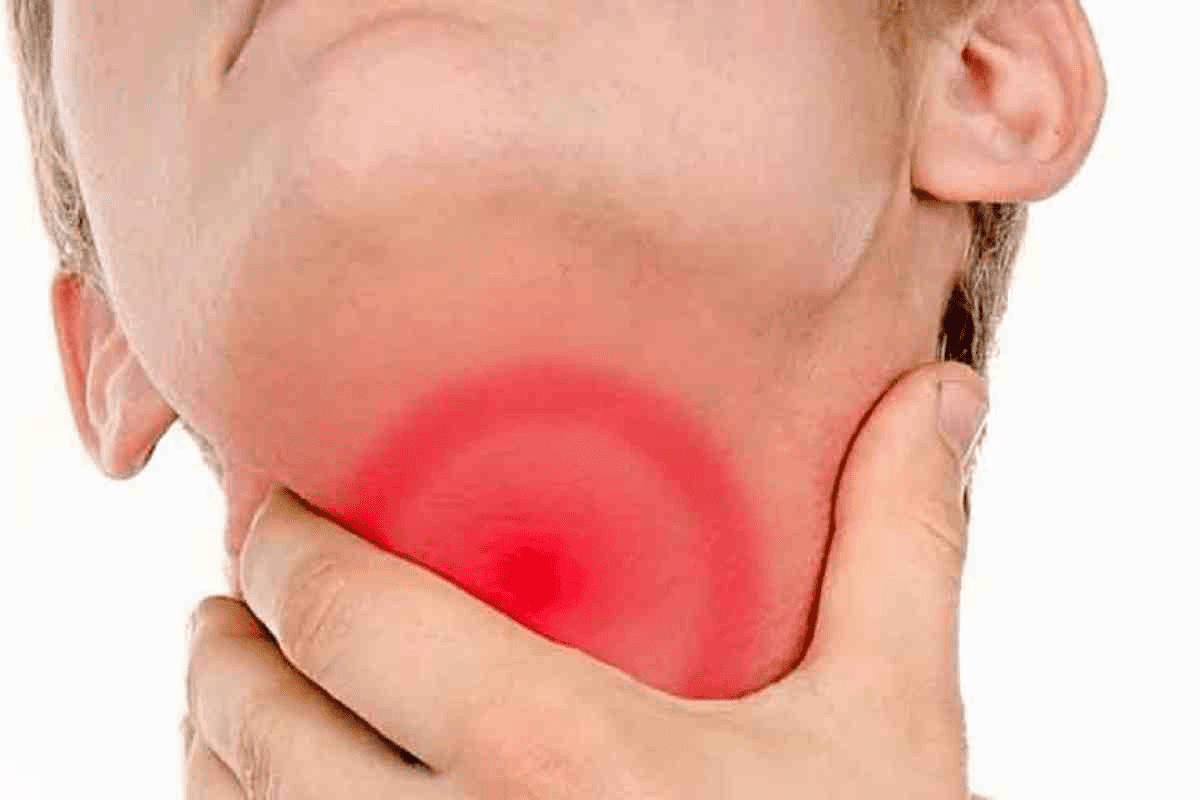 Pharyngitis Definition, Causes, and Facts