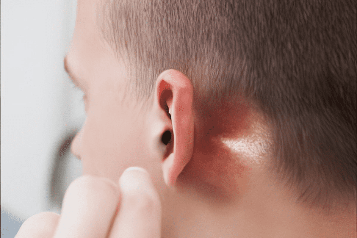 Lump Behind Ear Cancer: When to Worry About Cancer