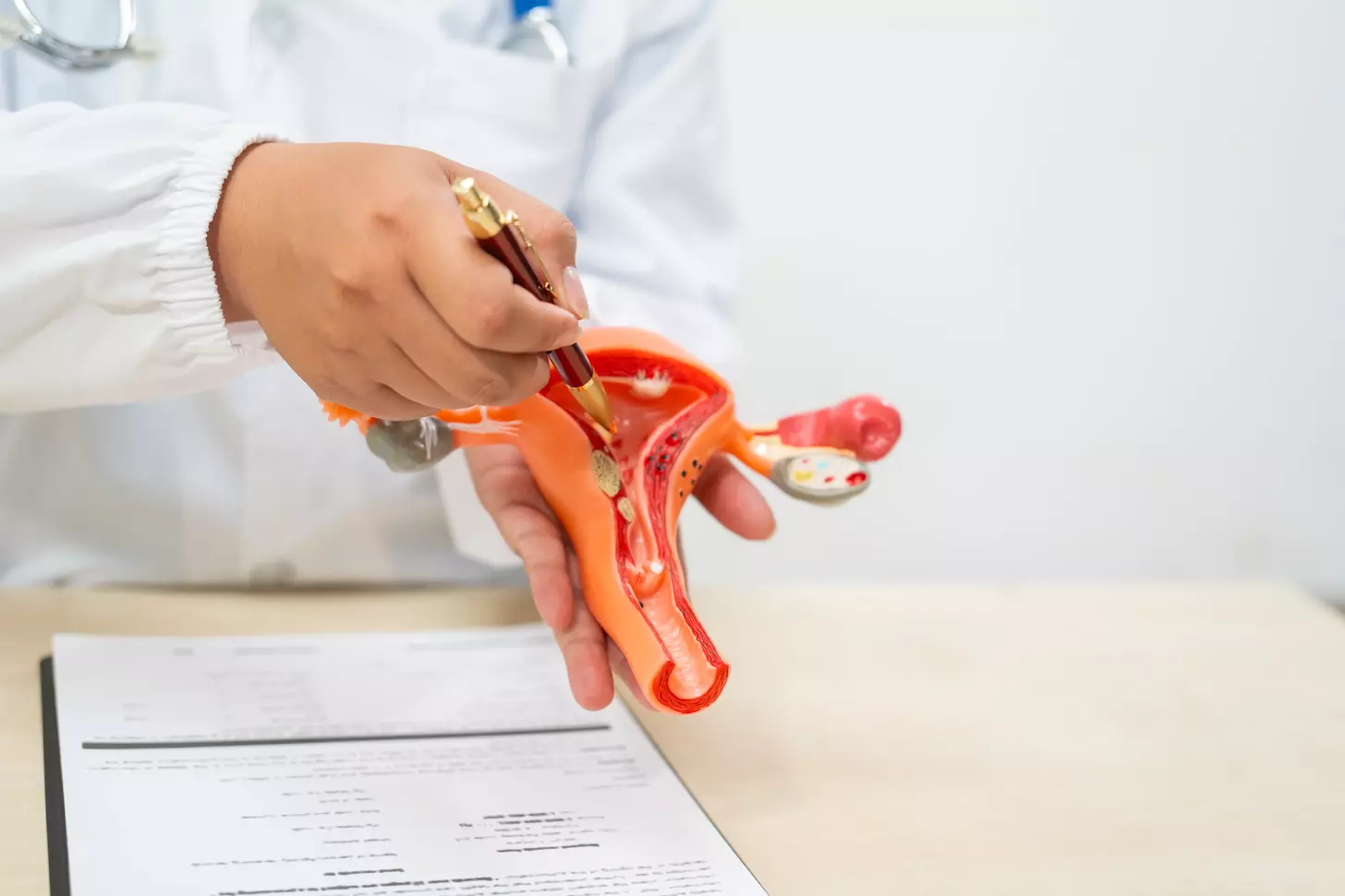 How to Perform Laparoscopic Hysterectomy Surgery: Step-by-Step Guide