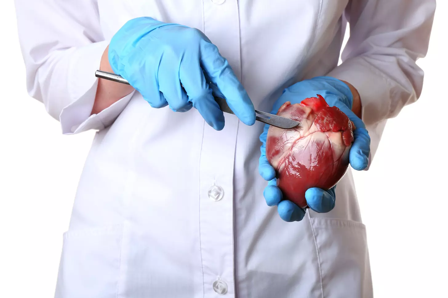 LIMA to LAD Bypass Graft: 7 Key Facts About the Gold Standard CABG