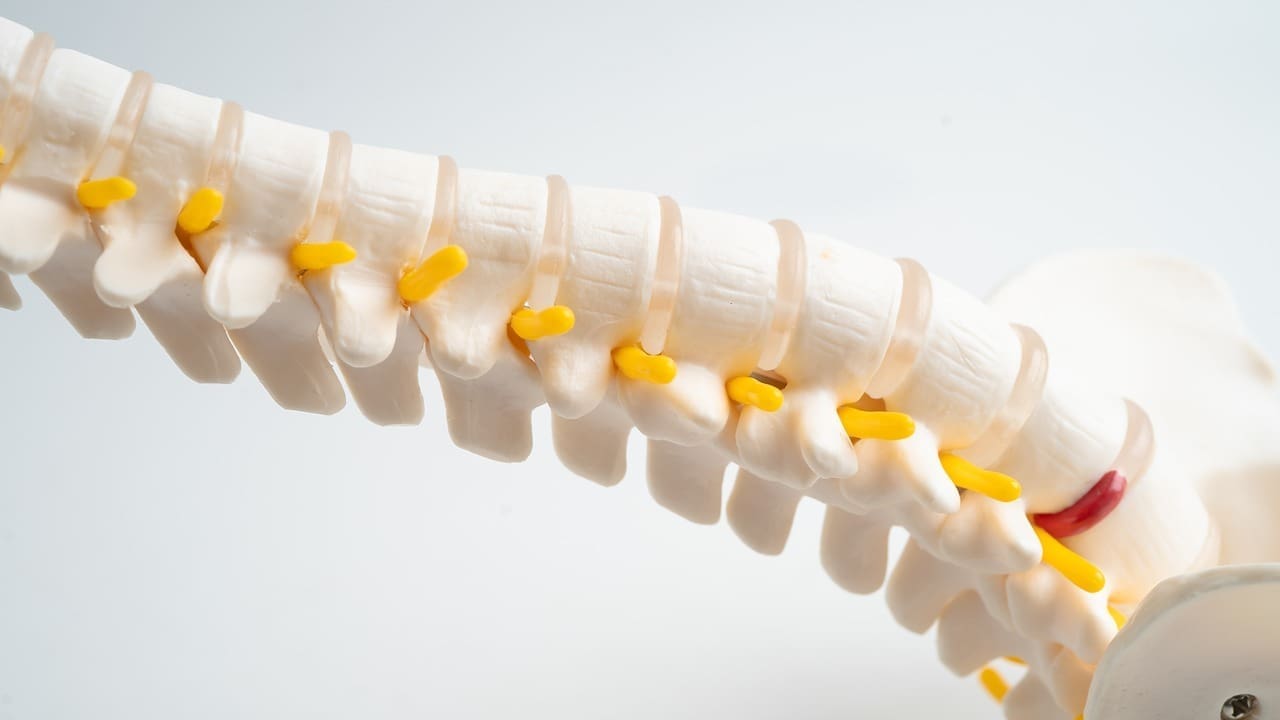 Lumbar Compression: 7 Key Steps for Managing Vertebral Compression Fractures