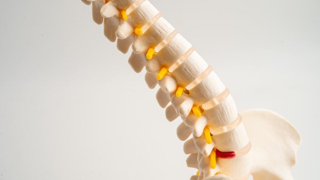 lumbar vertebral fusion lumbar vertebral fusion