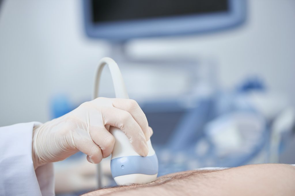 Can ultrasound detect ovarian cancer
