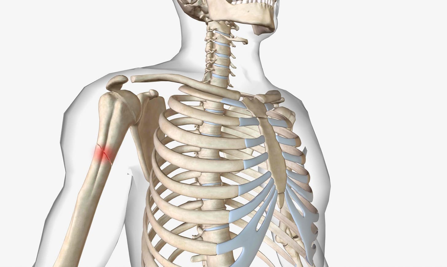 What Is Metastatic Bone Disease and How Are Osteoblastic and Osteolytic Metastases Classified?