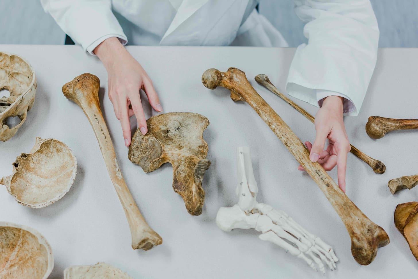 10 Key Facts About Mets to Bone and Lytic Bone Metastases