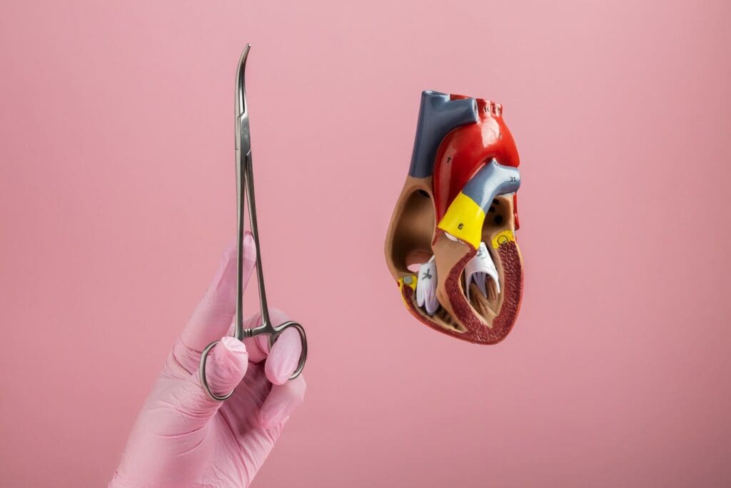 mitral annuloplasty